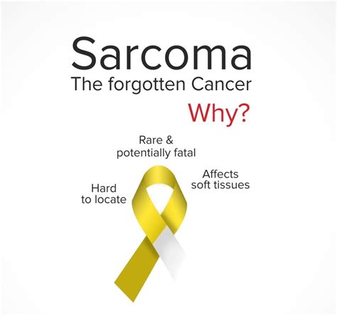 dr rock city of hope|Sarcoma treatment, symptoms, and testing .